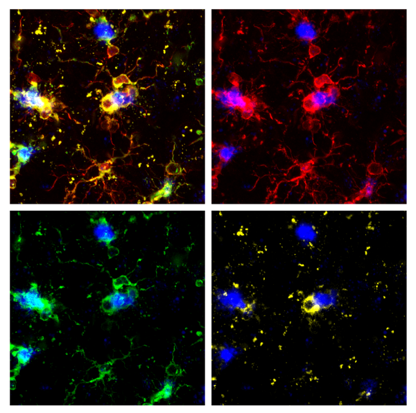 Multiplexing the Brain A Galaxy of Possibilities CST Blog